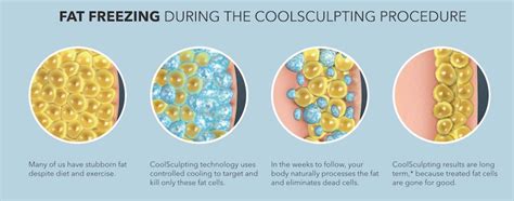 TOP 10 BEST Coolsculpting in Saint Louis, MO .